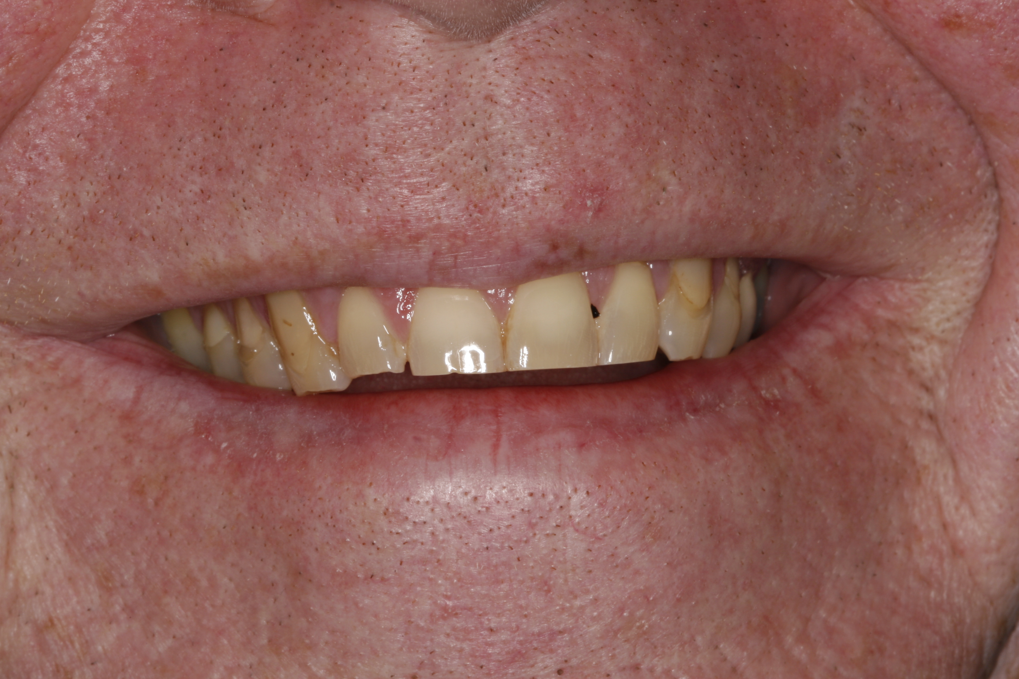 Wilsonville OR Dental treatment before
