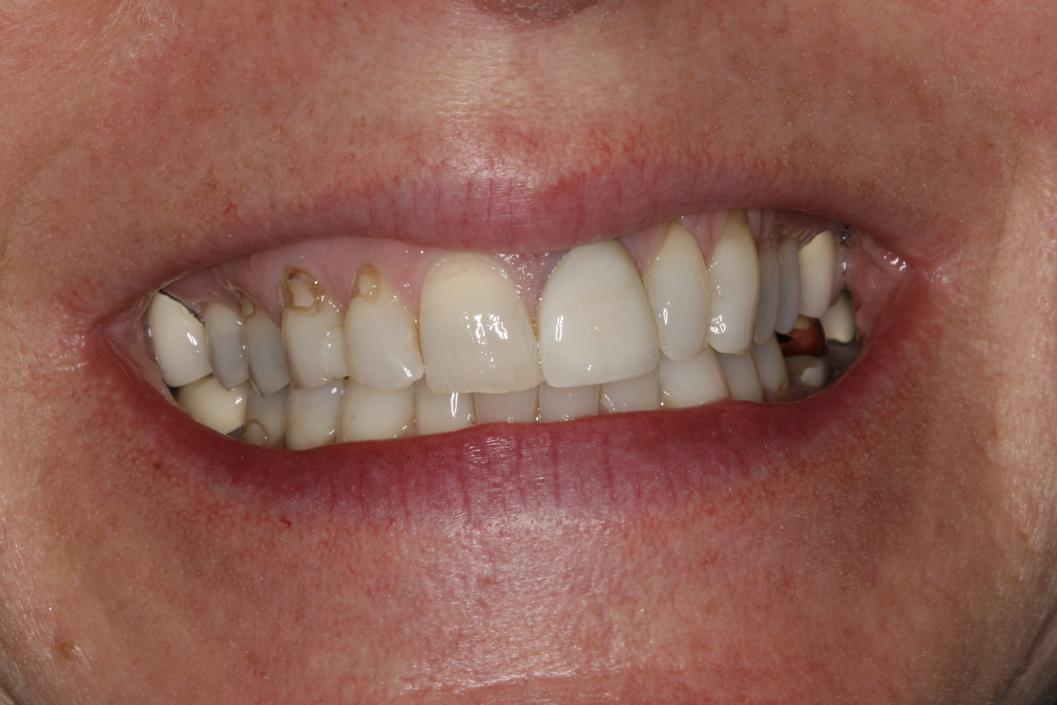 Before dental treatment Wilsonville OR