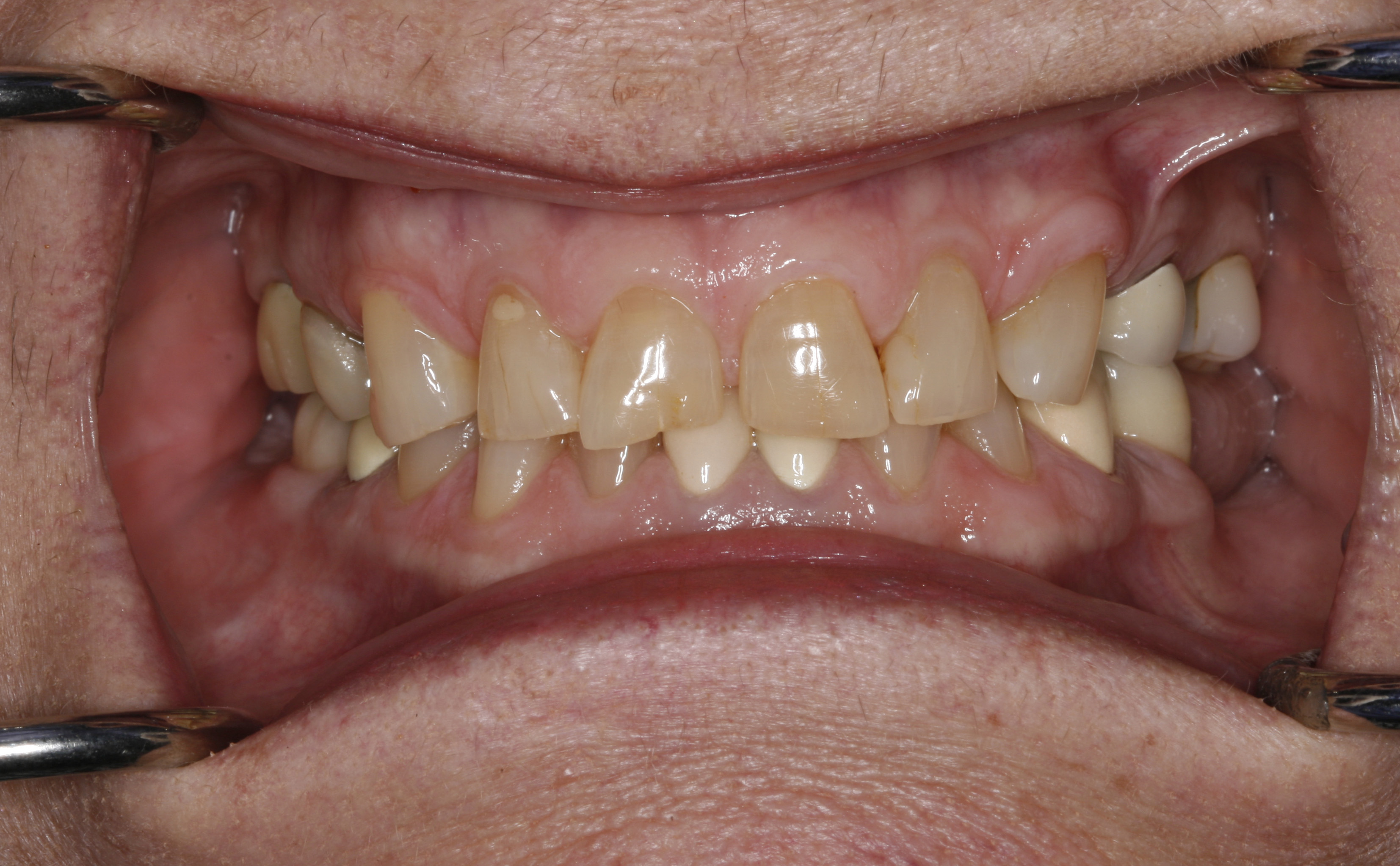Before Wilsonville dental treatment