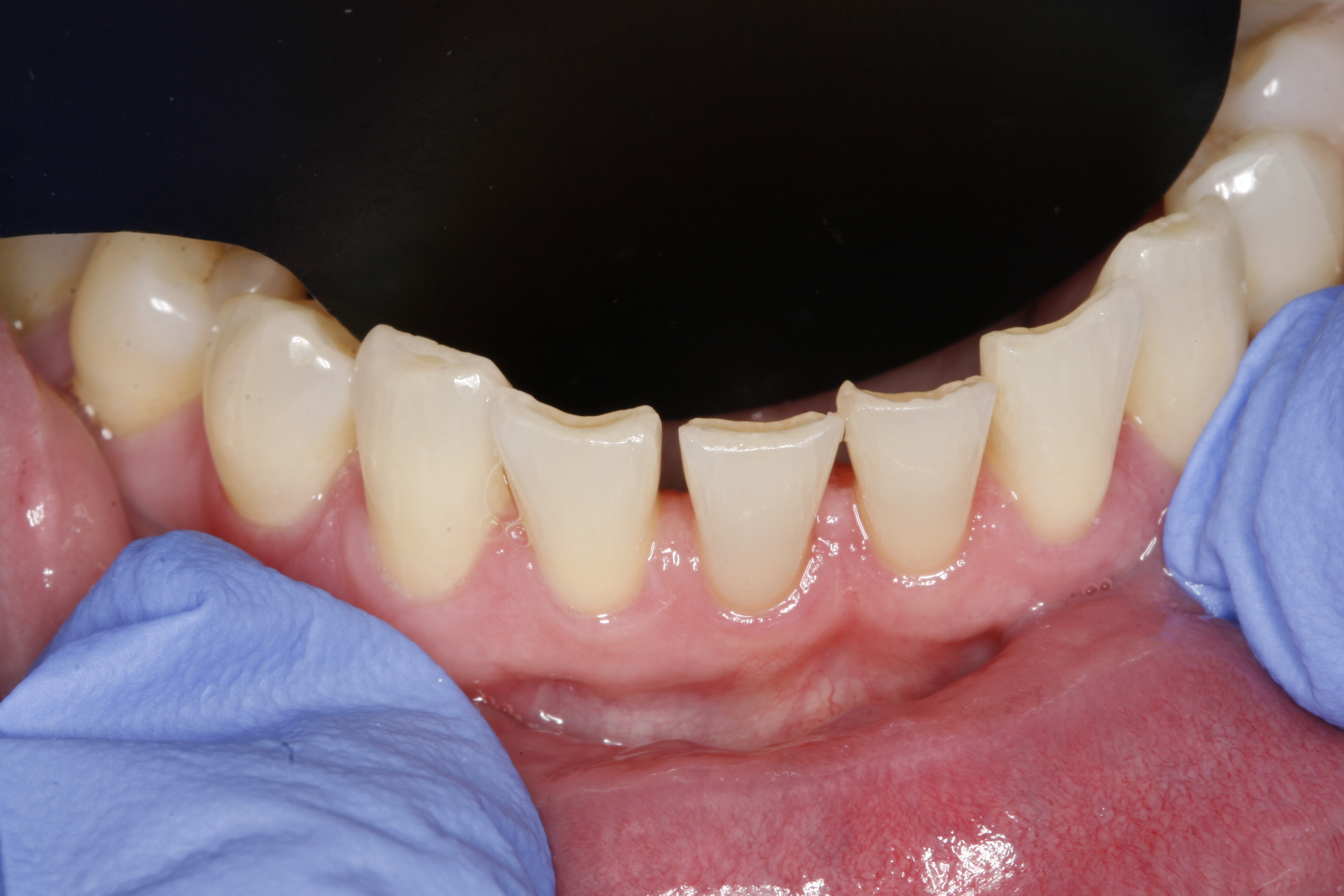 Wilsonville dental treatment before