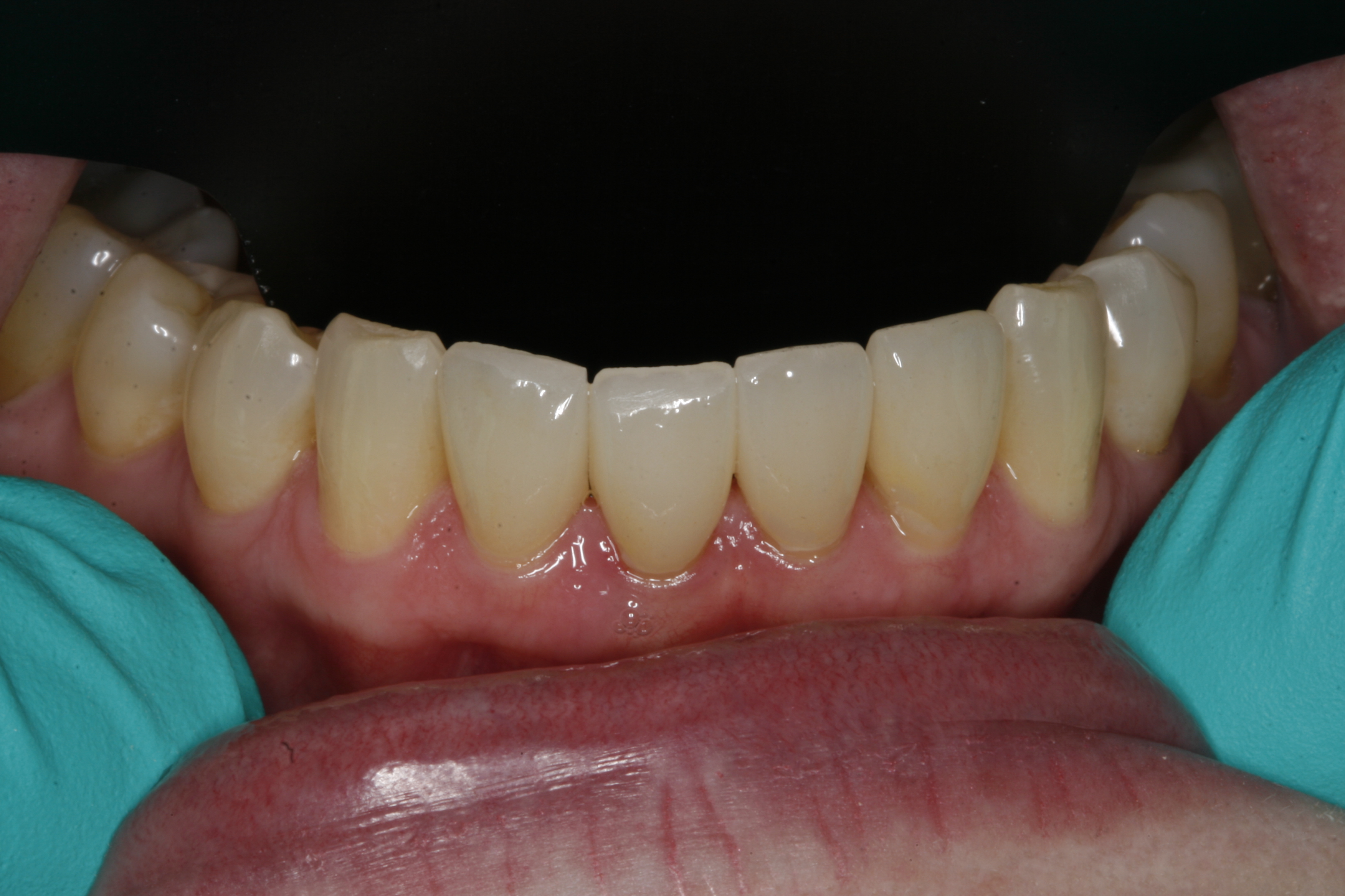 Wilsonville dental treatment after
