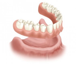 Full dentures at Bayer and Fahl Waukesha